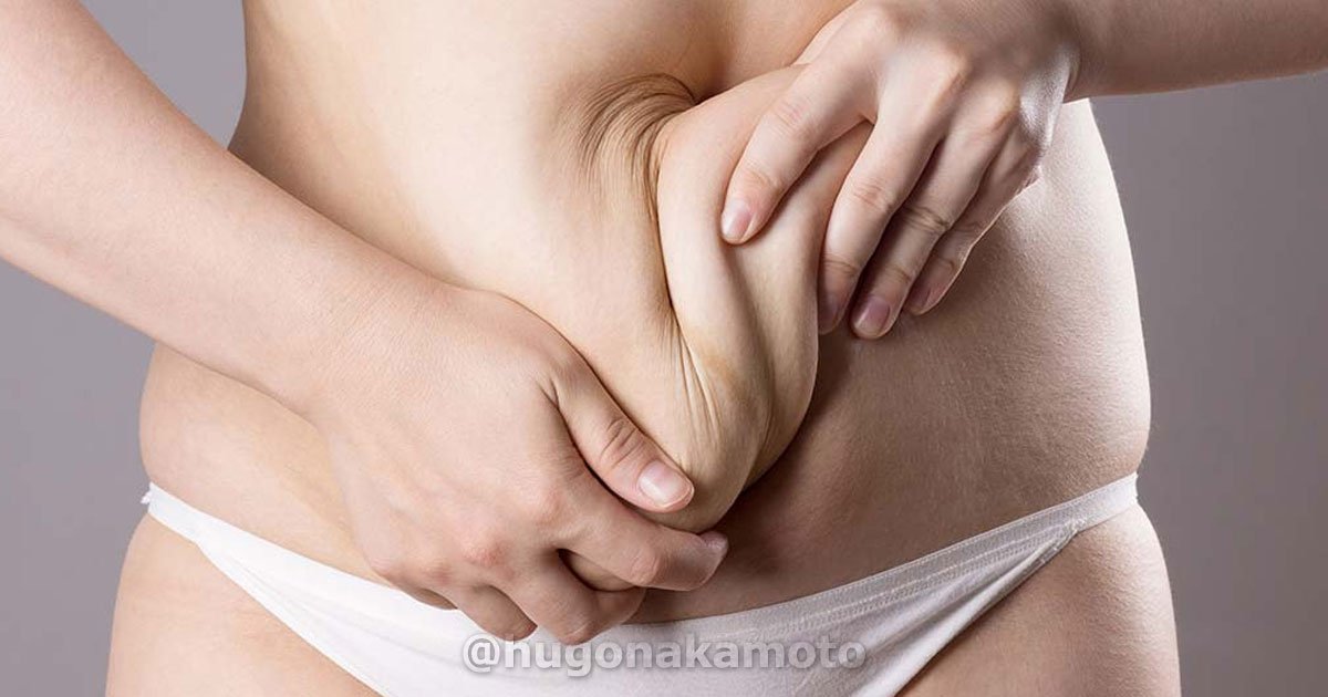 Dr Hugo Nakamoto Especialista Em Cirurgias Plasticas Pos Cirurgia Bariatrica Na Av Paulista