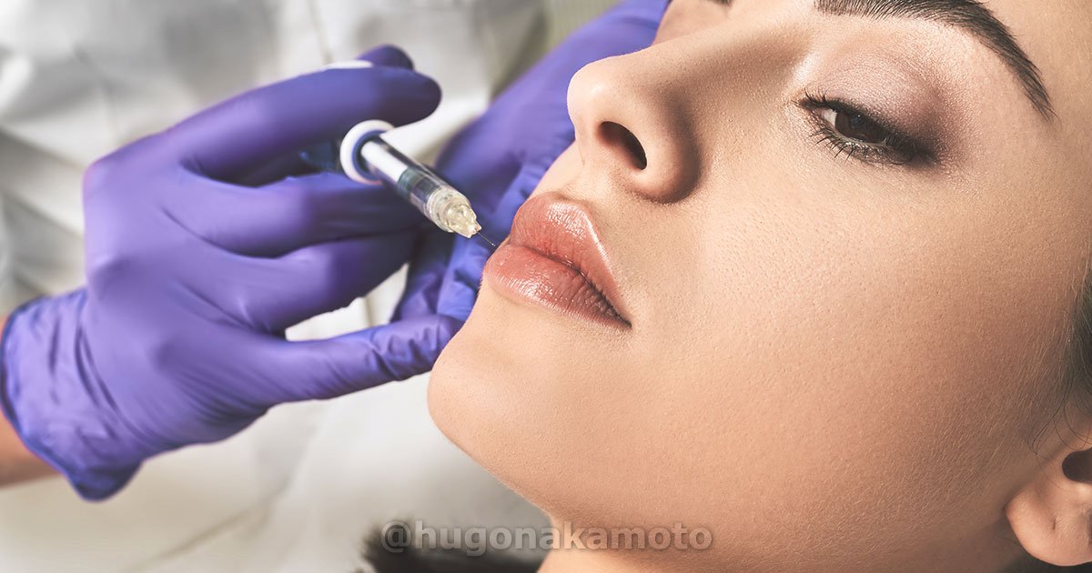 Dr Hugo Nakamoto Especialista Em Preenchimentos Na Av Paulista