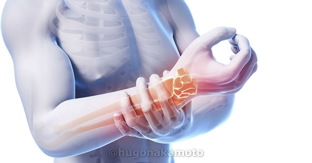 Dr Hugo Nakamoto Especialista Em Sindrome Do Tunel Do Carpo Nos Jardins