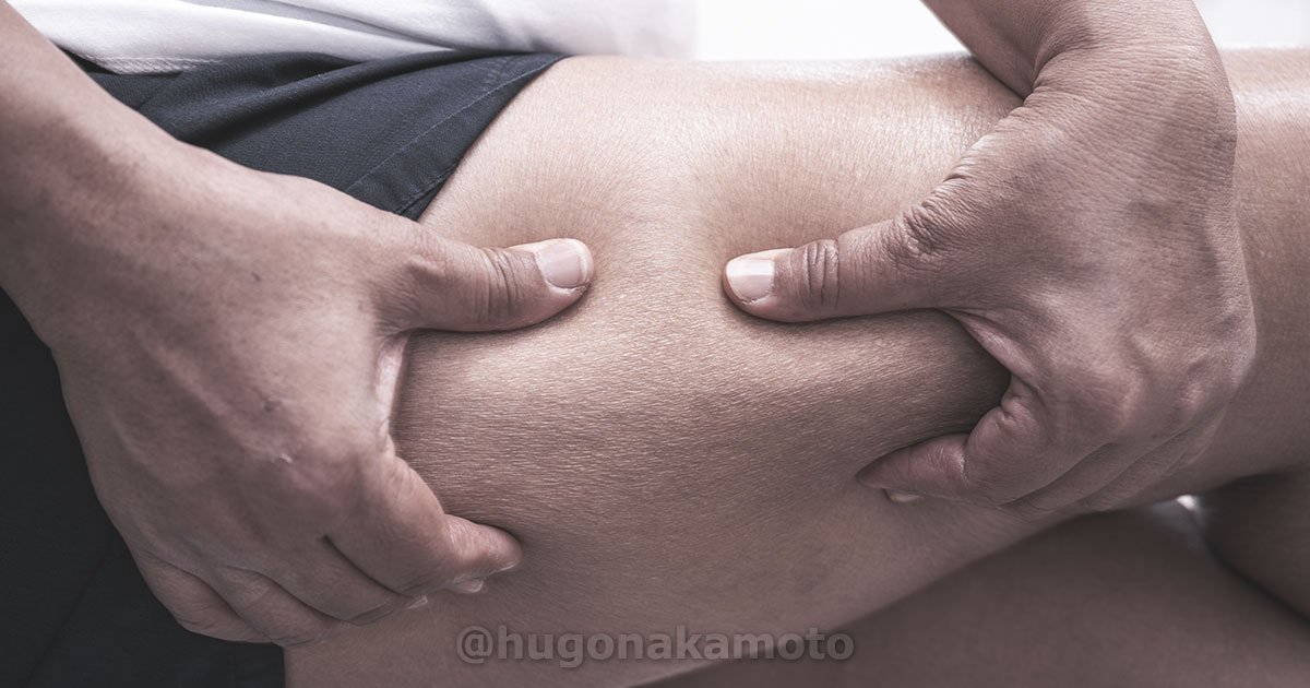 Dr Hugo Nakamoto Especialista Em Suspensao Das Coxas Na Av Paulista