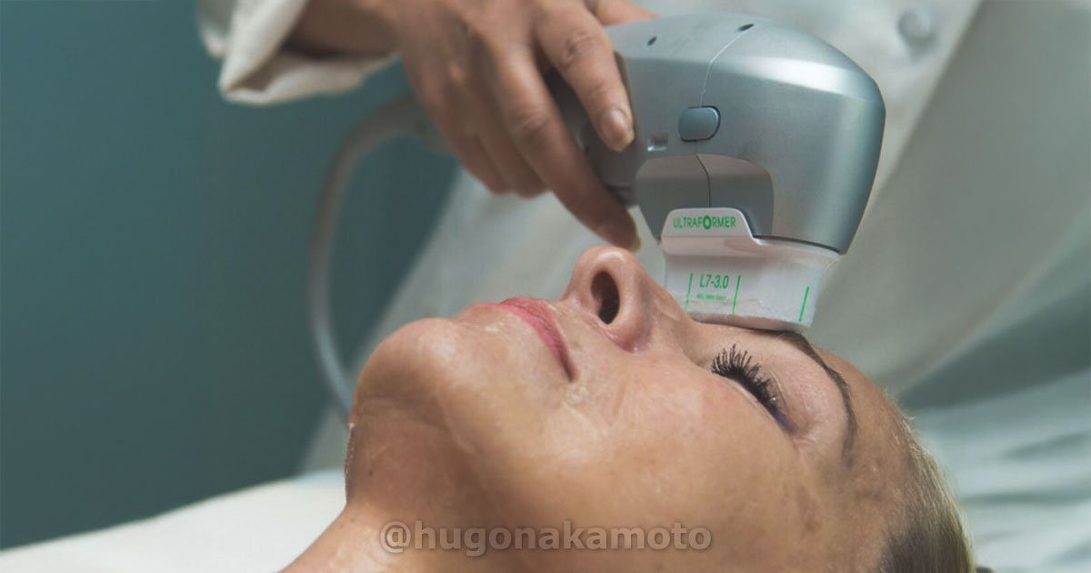 Dr Hugo Nakamoto Especialista Em Ultraformer 3 Na Av Paulista